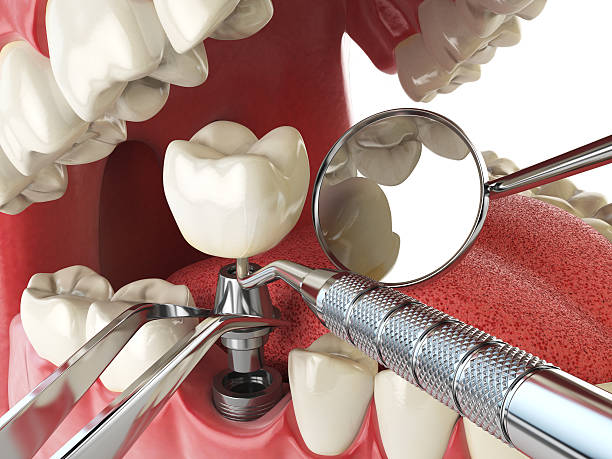Best Knocked-Out Tooth Emergency  in China Grove, TX